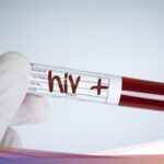 10 April Hari Kesadaran HIV dan AIDS Remaja Nasional, Begini Sejarahnya correctly being