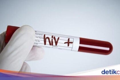 10 April Hari Kesadaran HIV dan AIDS Remaja Nasional, Begini Sejarahnya correctly being