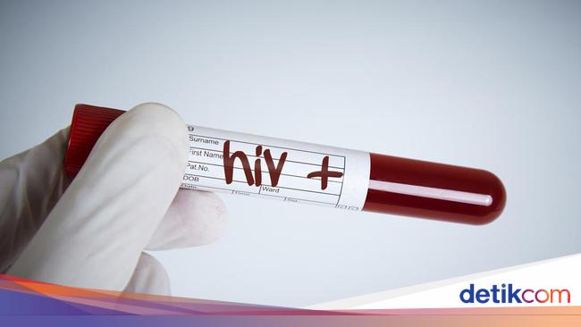 10 April Hari Kesadaran HIV dan AIDS Remaja Nasional, Begini Sejarahnya correctly being