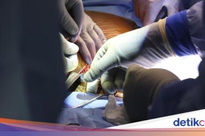 Pengakuan Richard Slayman yang Sukses Terima Cangkok Ginjal Babi health