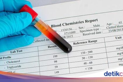 Dokter Gizi Ungkap Makanan Penurun Kolesterol usai Kalap Makan Daging saat Lebaran health