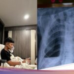 Viral Pria 18 Tahun di Klaten 4 Kali Masuk RS usai Ngevape-Rokok Kesehatan – FBS Foreign exchange Bitcoin Stock